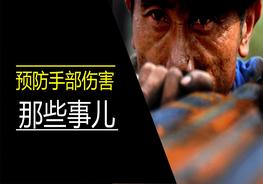 手部事故預(yù)防那些事兒pptx
