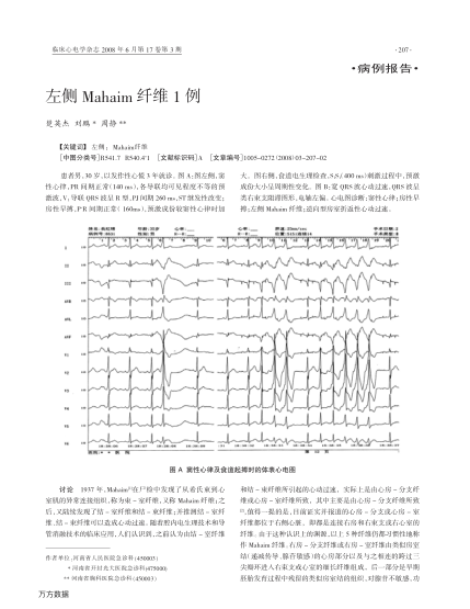 左側(cè)Mahaim纖維1例