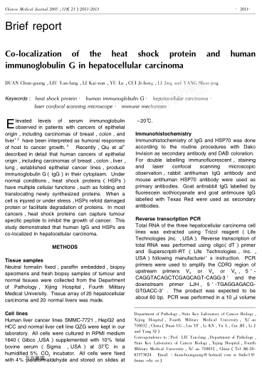 Co-localization of the heat shock protein and human immunoglobulin G in hepatocellular carcinoma