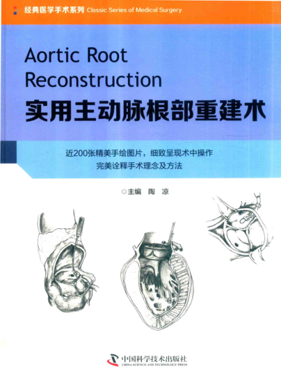 實(shí)用主動(dòng)脈根部重建術(shù) 2019年版 陶涼 著