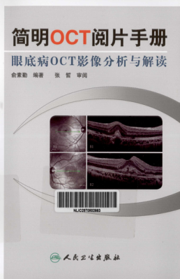 簡明OCT閱片手冊 眼底病OCT影像分析與解讀 俞素勤 主編 2012年版